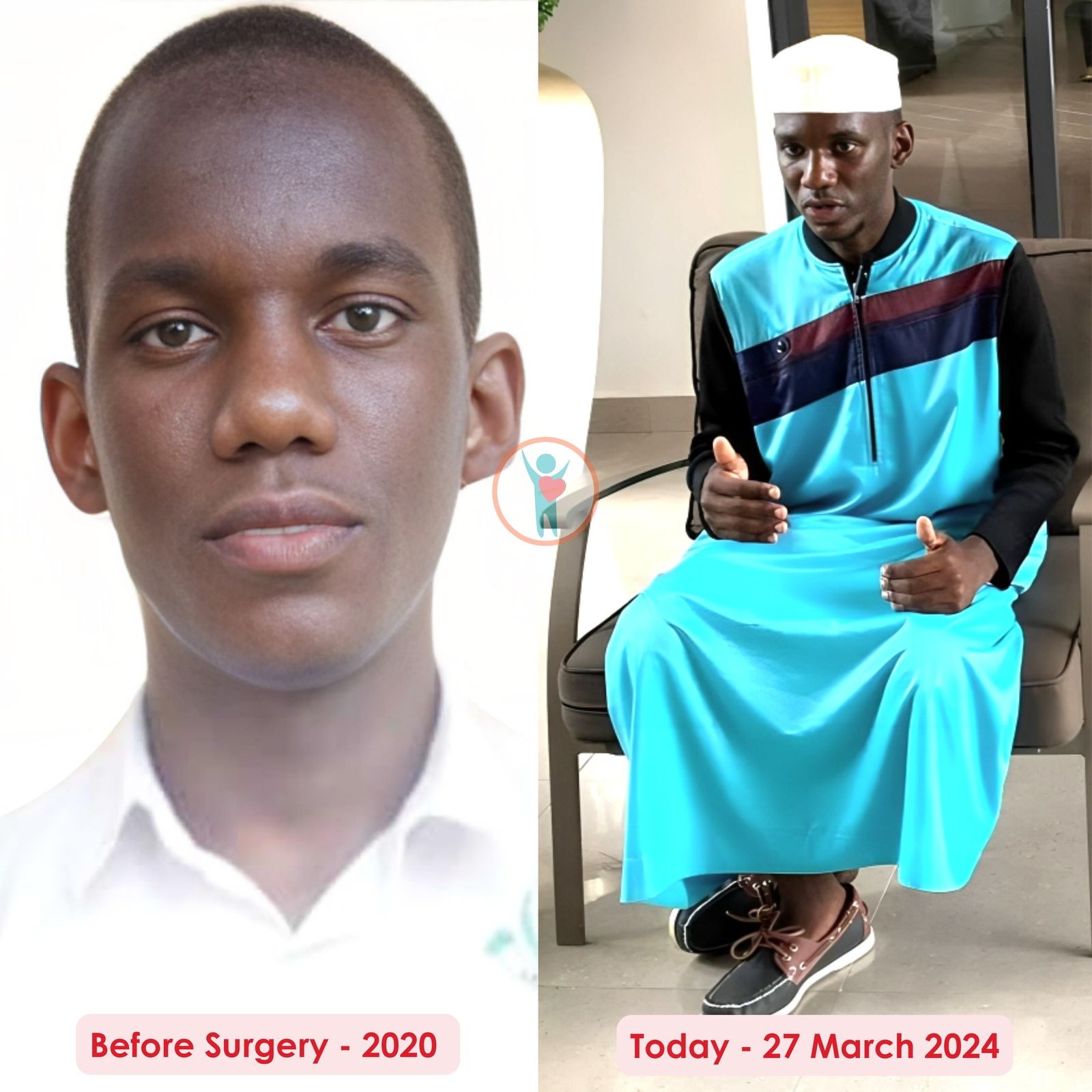Photograph from: Rayhan: surgery in India and a hard recovery