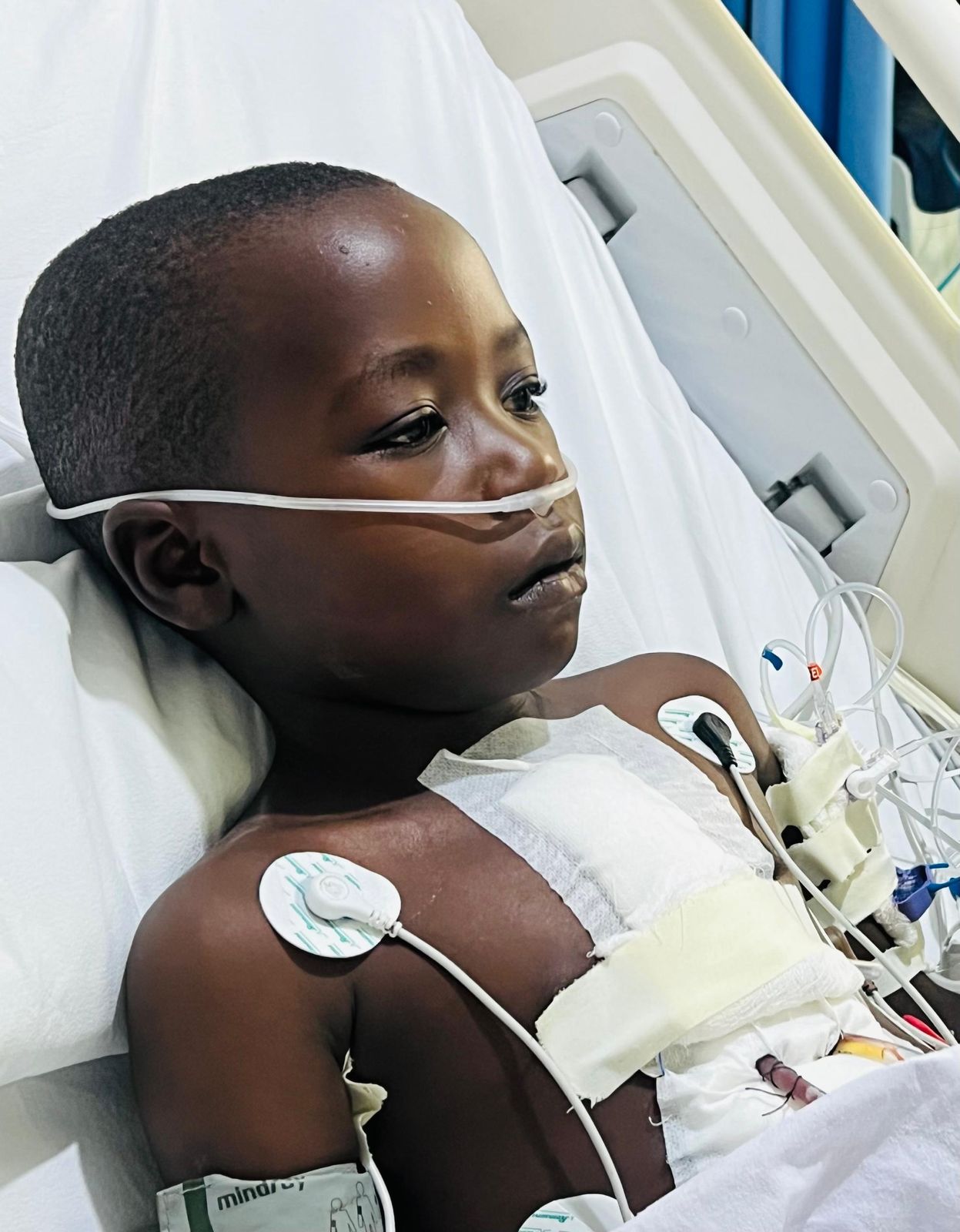 A child with oxygen tubing and monitoring leads rests in a hospital bed